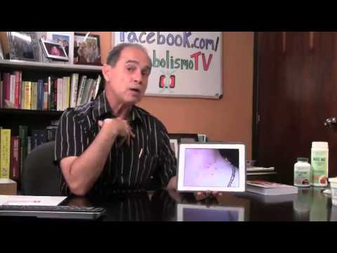 Episodio #533 Verrugas, Obesidad y Diabetes